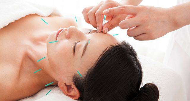 様々な体調不良にも効果的な鍼灸